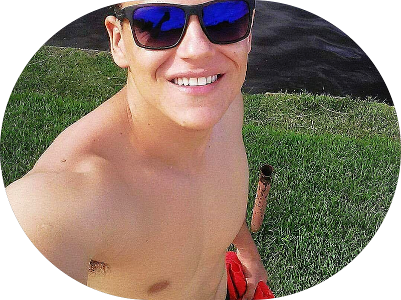 Foto 6 de Sorridents Vila Velha | Clareamento Dental, Implante, Tratamento de Canal, Facetas, Prótese, Aparelho Dental, Siso