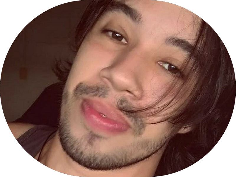 Foto 8 de Sorridents Vila Velha | Clareamento Dental, Implante, Tratamento de Canal, Facetas, Prótese, Aparelho Dental, Siso