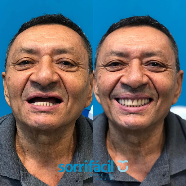 Foto 2 de Sorrifácil