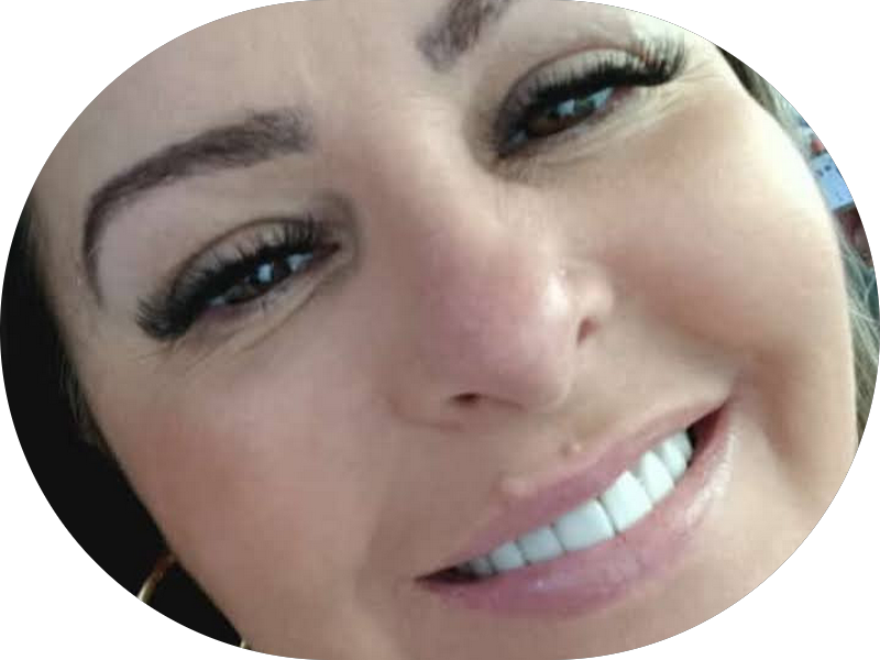 Foto 5 de Sorrifácil Americana