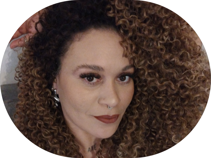 Foto 5 de Sorrifácil Campina Grande | Implantes Dentários, Prótese Protocolo, Reabilitação Oral e Lentes de Contato