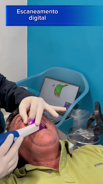 Foto 3 de Sorrifácil Caruaru | Implantes Dentários, Prótese Protocolo, Reabilitação Oral e Lentes de Contato