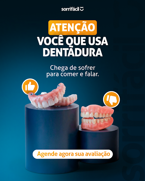 Foto 3 de Sorrifácil Erechim - Implantes Dentarios, Clareamento, lentes de contato, alinhador invisível e mais!