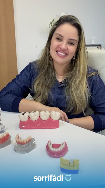 Foto 3 de Sorrifácil Maceió | Implantes, Prótese Protocolo, Reabilitação Oral e Lentes de Contato