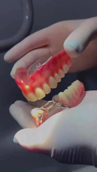 Foto 4 de Sorrifácil Mogi Das Cruzes - Implantes dentários, clareamento, lentes de contato, alinhador invisível e mais!