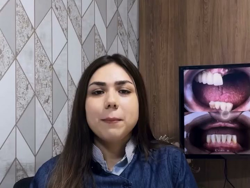 Foto 4 de Sorrifácil Rio Branco | Implantes Dentários, Prótese Protocolo, Reabilitação Oral e Lentes de Contato