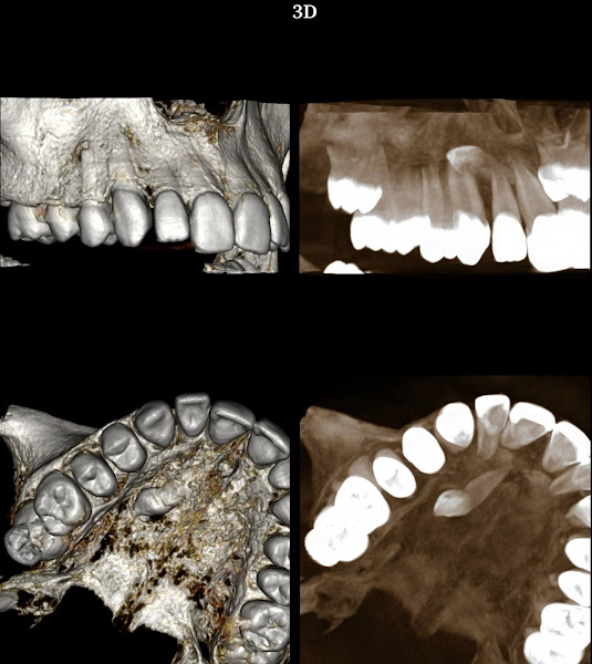 Foto 3 de Sorrimagem Radiologia Odontológica
