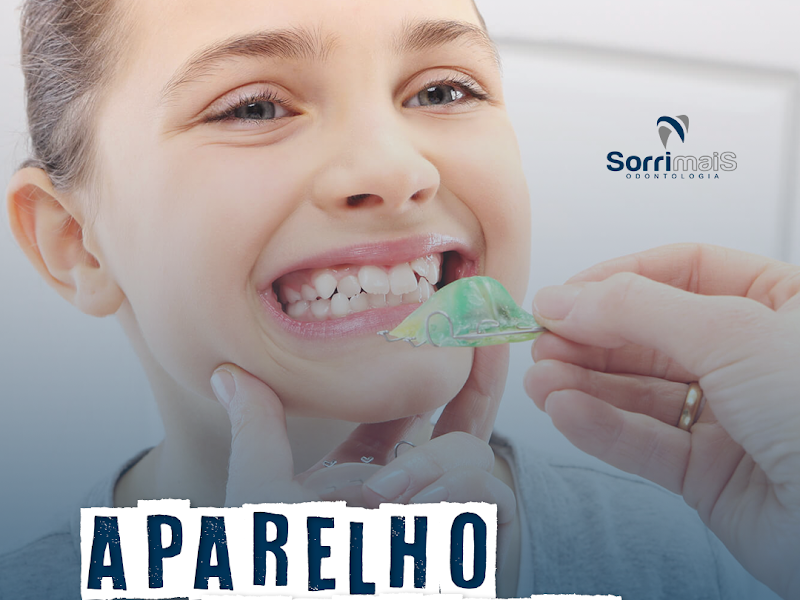 Foto 4 de SorriMais Odonto Gama