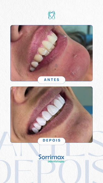 Foto 4 de Sorrimax Odontologia