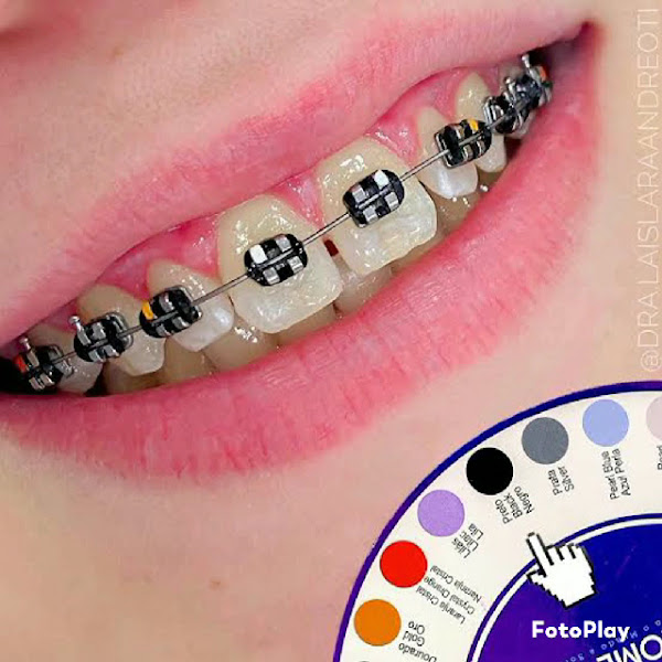 Foto 3 de Sorrimed Clínica Odontológica - Mathias Velho