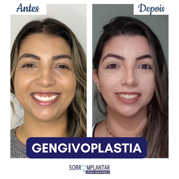 Foto 3 de Sorrimplantar Clínica Odontológica