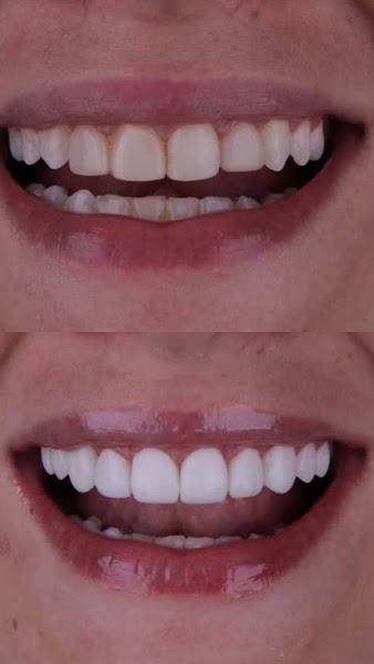 Foto 2 de SORRINDO FORTALEZA.