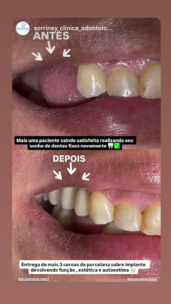 Foto 3 de Sorriney Clinica Odontológica
