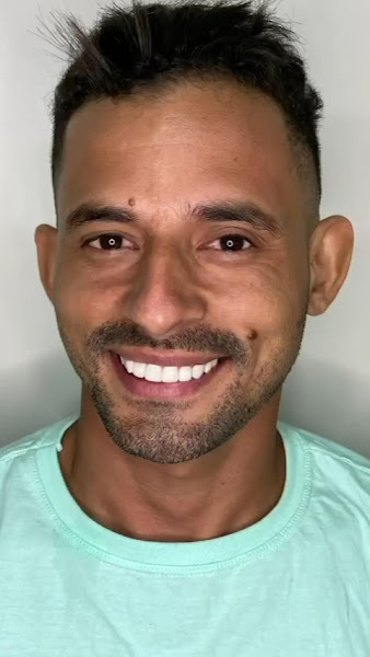 Foto 3 de SorriPop - Dentistas em Prazeres