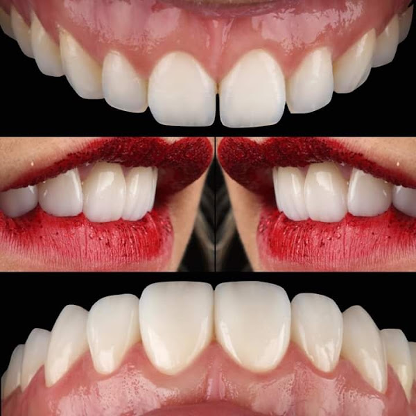 Foto 4 de Sorrir Arte - Dentista em Rio Branco