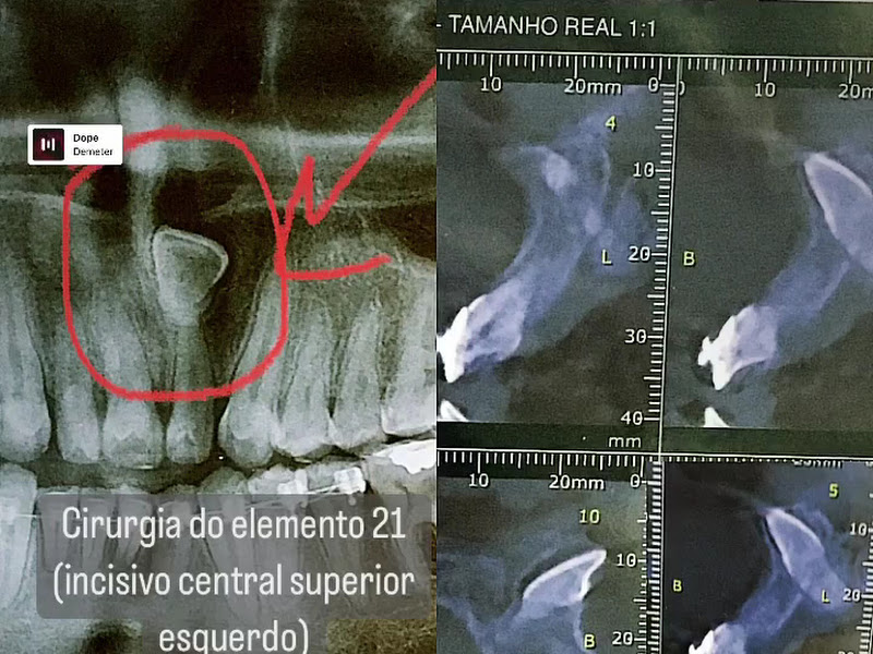 Foto 2 de SORRIR FÁCIL | CLÍNICA ODONTOLÓGICA EM ARTUR ALVIM