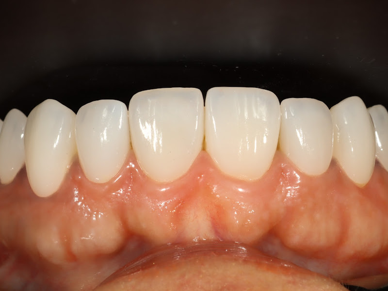 Foto 2 de Sorrir Melhor - Lavras