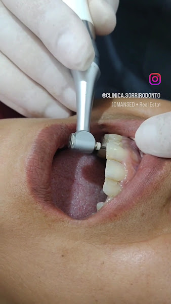 Foto 3 de Sorrir Odonto