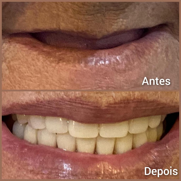 Foto 3 de Sorrir Odontologia Avançada