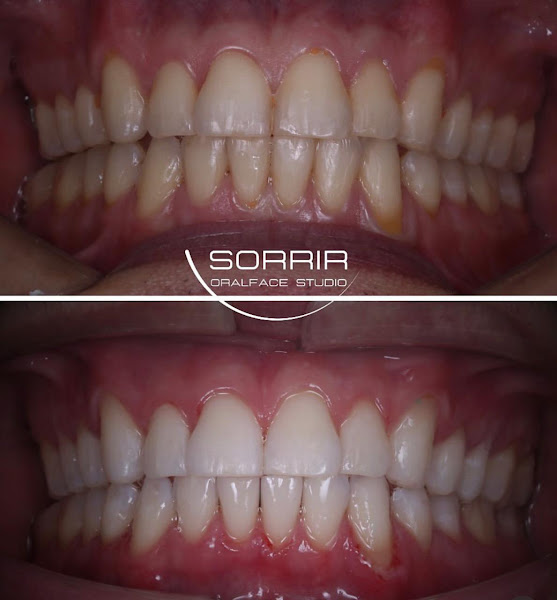 Foto 2 de Sorrir Oralface Studio