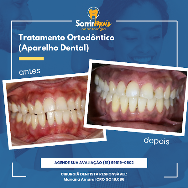 Foto 3 de SorrirMais Odontologia
