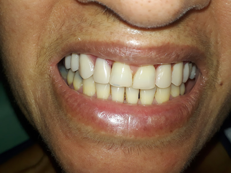 Foto 3 de SORRISO