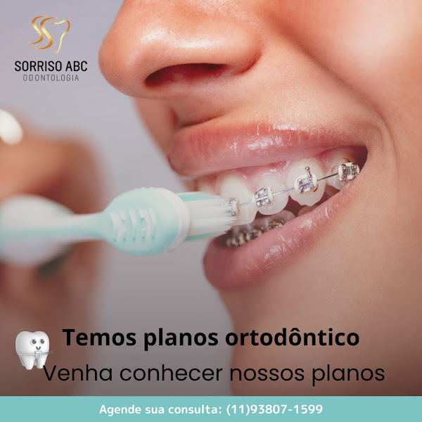 Foto 4 de Sorriso ABC