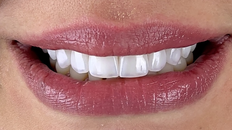 Foto 2 de SORRISO CLASS