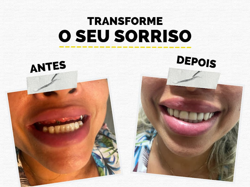 Foto de Sorriso da Família