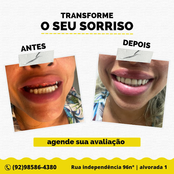 Foto 2 de Sorriso da Família
