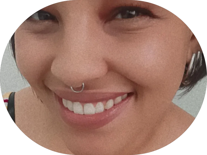 Foto 4 de Sorriso da Granja