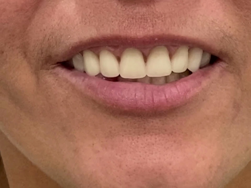 Foto 4 de Sorriso de Campinas