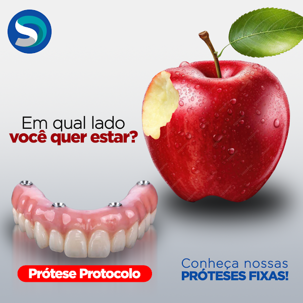 Foto de Sorriso Digital Ipatinga - Implantes Dentários, Prótese, Protocolo