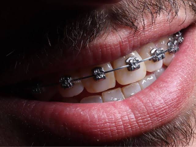 Foto 2 de SORRISO DO POVO III - ROTATORIA VILA DIRCE