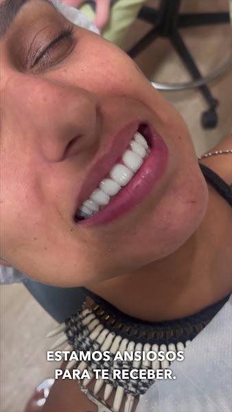 Foto 3 de Sorriso e Face