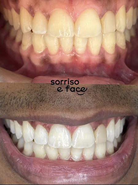 Foto 2 de Sorriso e Face Resende