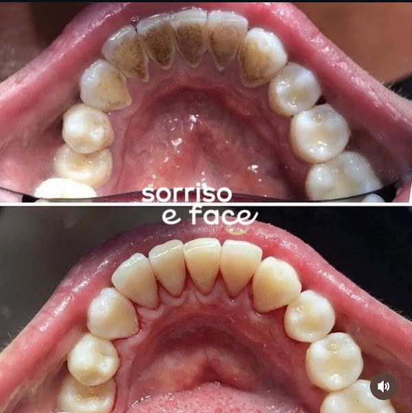 Foto 3 de Sorriso e Face Resende