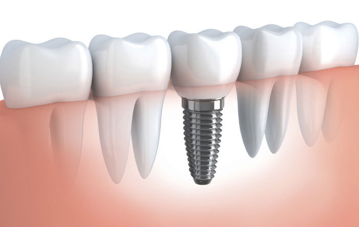 Foto 3 de Sorriso e Saúde Consultório Odontológico