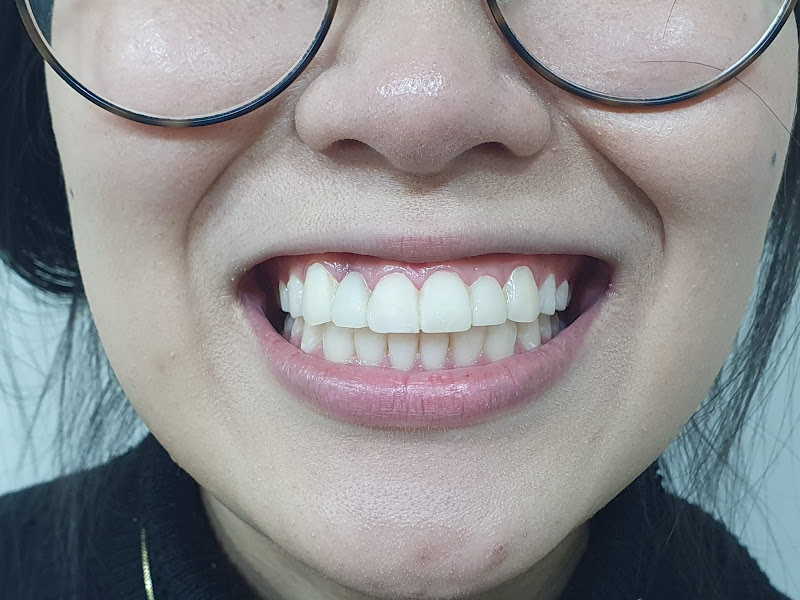 Foto 2 de Sorriso Ferraretto Odontologia | Dentista Vila Formosa | Implantologista 24h