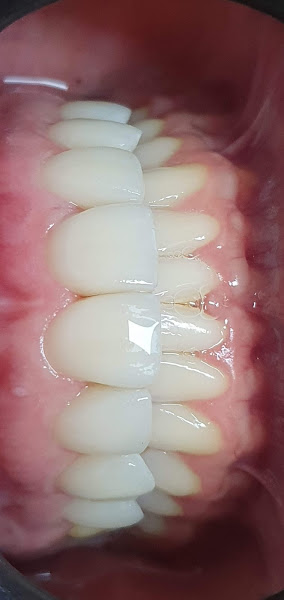 Foto 3 de Sorriso Ferraretto Odontologia | Dentista Vila Formosa | Implantologista 24h