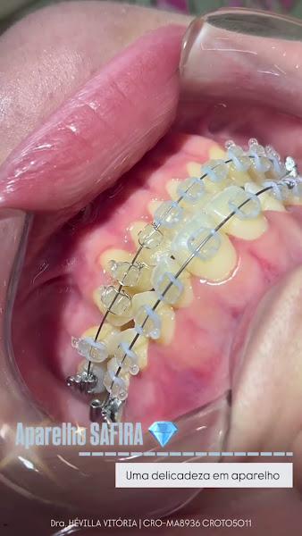 Foto 3 de Sorriso Ideal - Clínica Odontológica