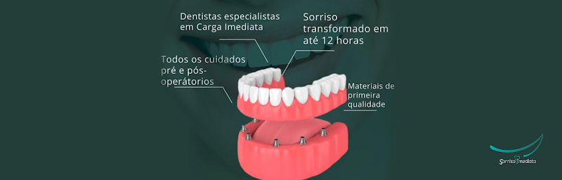 Foto 2 de Sorriso Imediato - Palhoça