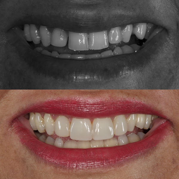 Foto 3 de Sorriso Implantes
