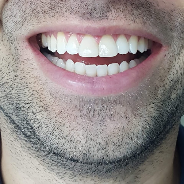 Foto 2 de Sorriso Livre Odontologia