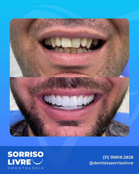 Foto 3 de Sorriso Livre Odontologia