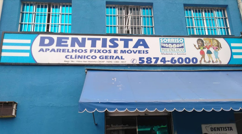 Foto 2 de Sorriso Metalico