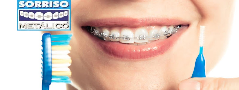 Foto 2 de Sorriso Metálico Embu