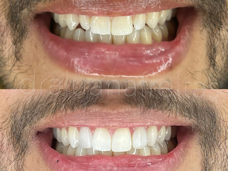 Foto 10 de SORRISO NEW CONSULTÓRIO ODONTOLÓGICO