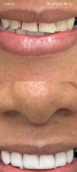 Foto 3 de +Sorriso Odontologia Grajaú