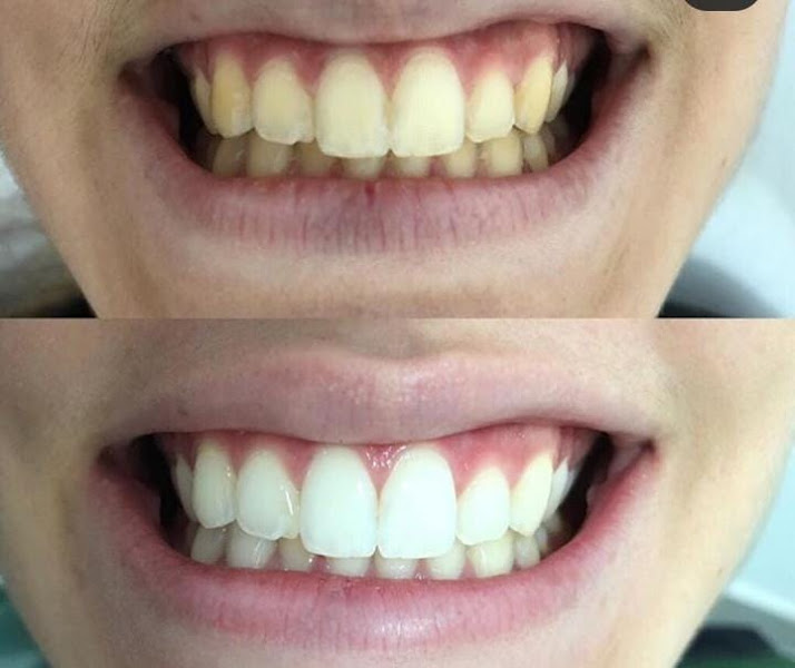 Foto 2 de Sorriso Paulistana